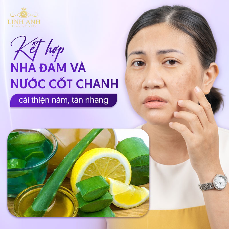 Cách làm mặt nạ nha đam trị nám tàn nhang