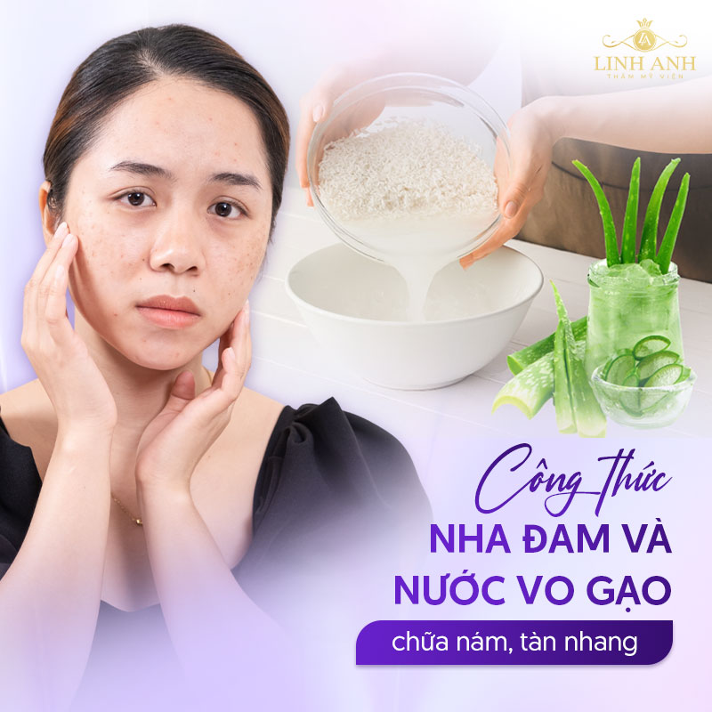 Trị nám bằng nha đam vo gạo