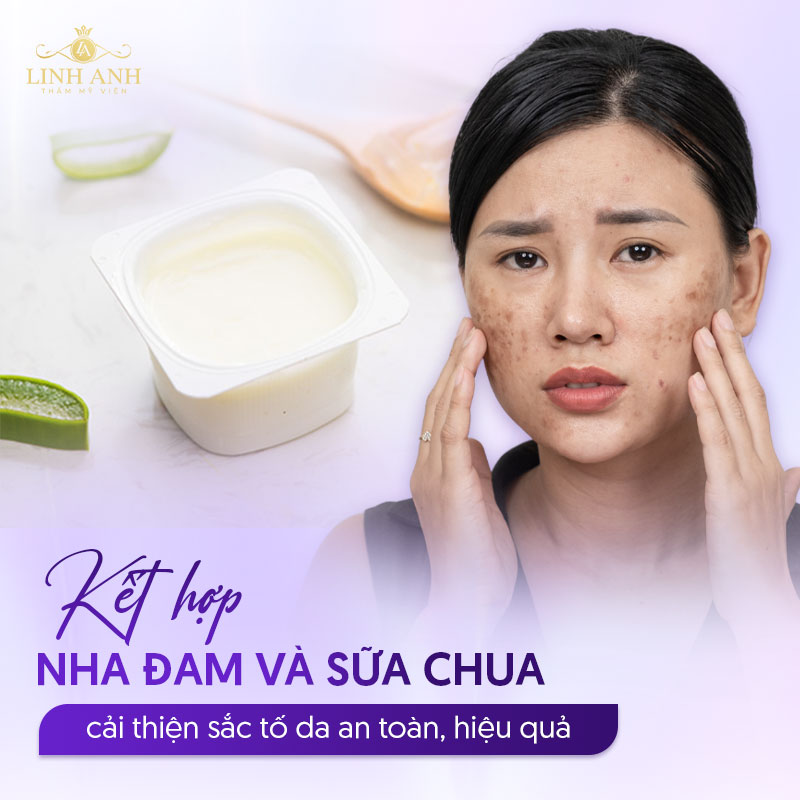 Kết hợp sữa chua và nha đam trị nám