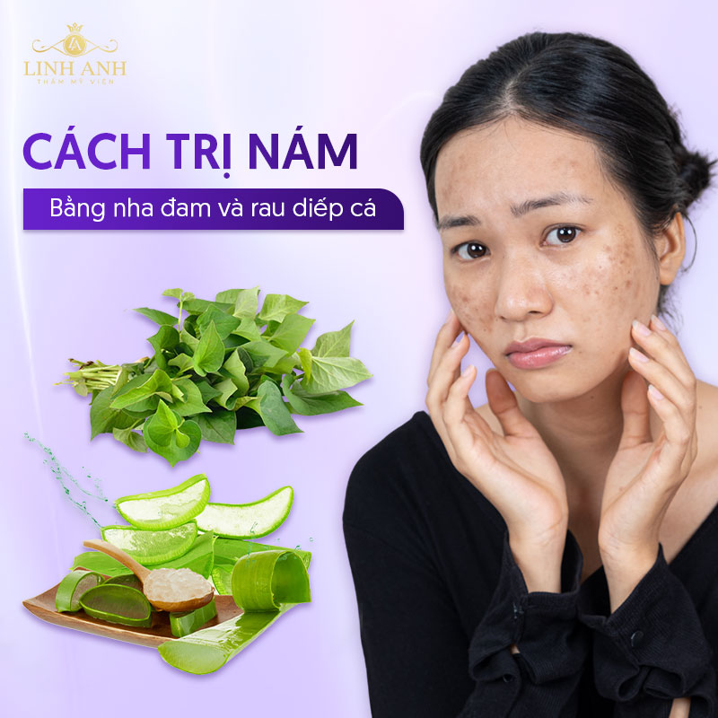 Cách trị nám bằng nha đam và rau diếp cá