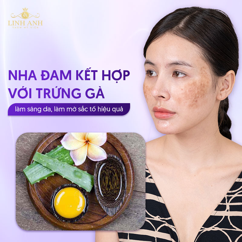 Cách trị nám bằng nha đam và trứng gà