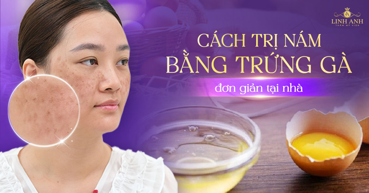 10 cách trị nám bằng trứng gà đơn giản tại nhà