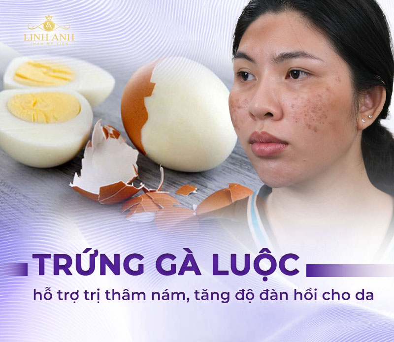Trị nám bằng trứng gà luộc
