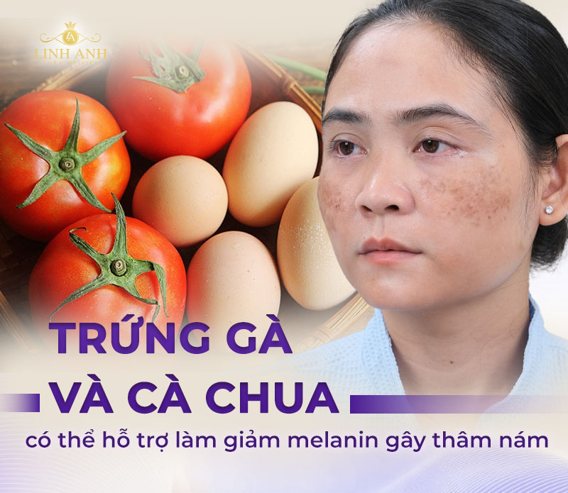Trị nám bằng trứng gà và cà chua