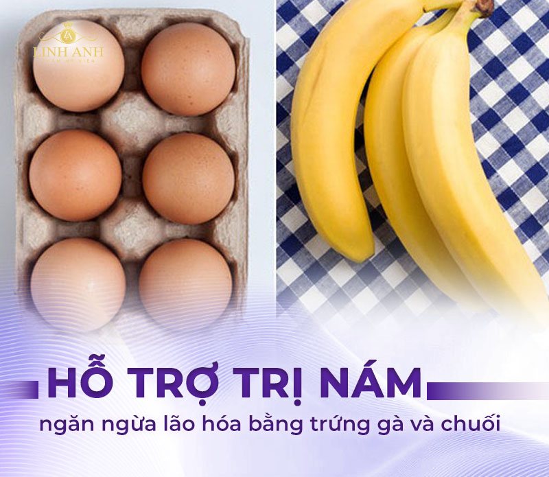 Trị nám bằng trứng gà và chuối