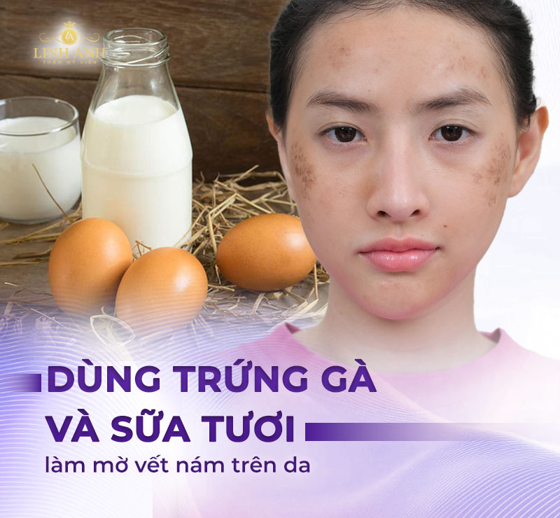 Trị nám bằng trứng gà và sữa tươi