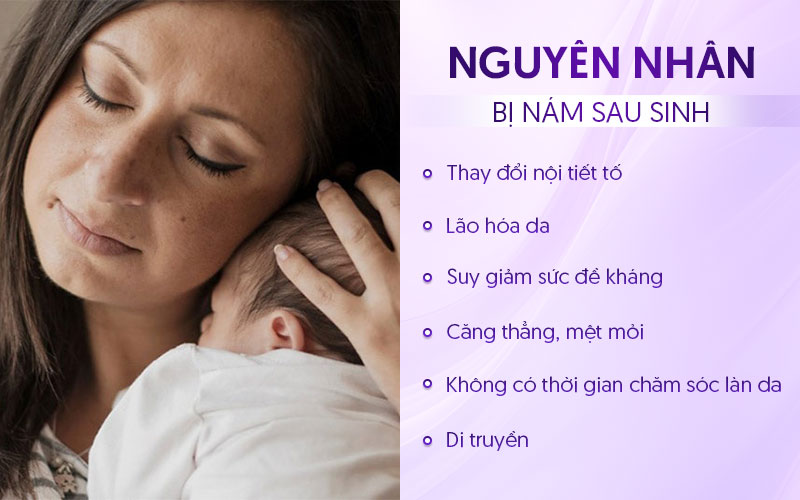 Nguyên nhân bị nám sau sinh