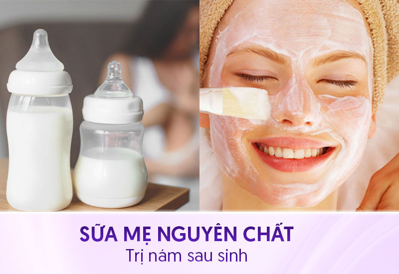 Trị nám sau sinh bằng sữa mẹ nguyên chất