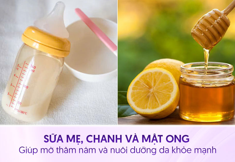 Kết hợp chanh, mật ong và sữa mẹ trị nám sau sinh