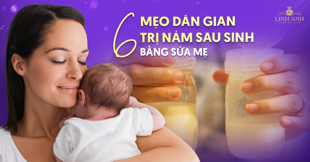 6 mẹo dân gian trị nám sau sinh bằng sữa mẹ nên thử