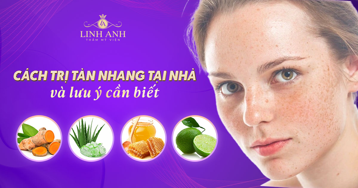 13 cách trị tàn nhang tại nhà an toàn và lưu ý cần biết