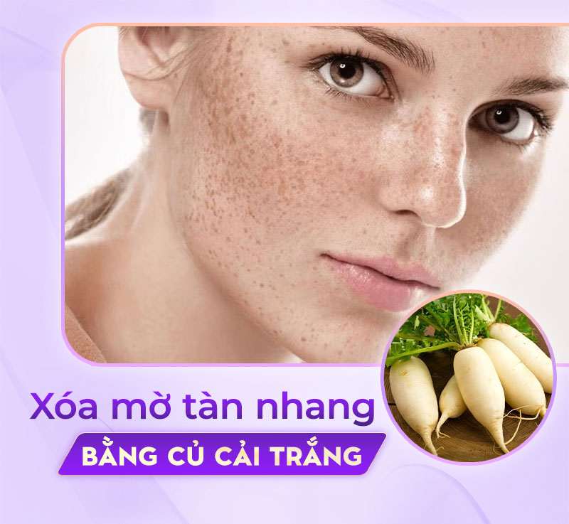 củ cải trắng giúp sáng da, giảm thâm nám và tàn nhang