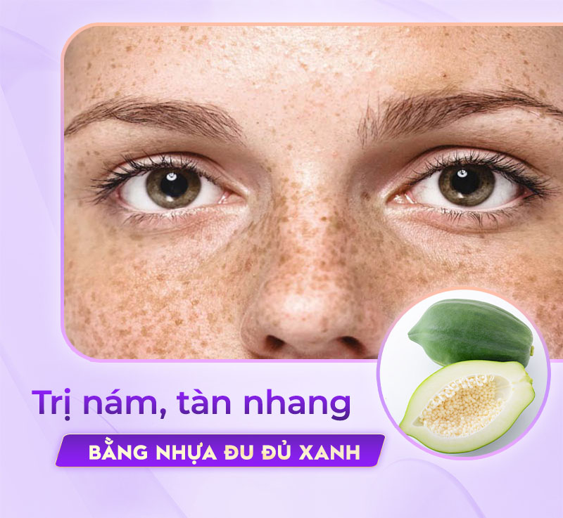 nhựa đu đủ giúp làm mờ tàn nhang