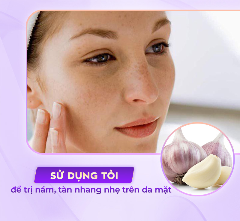 xóa tàn nhang, kháng viêm với tỏi