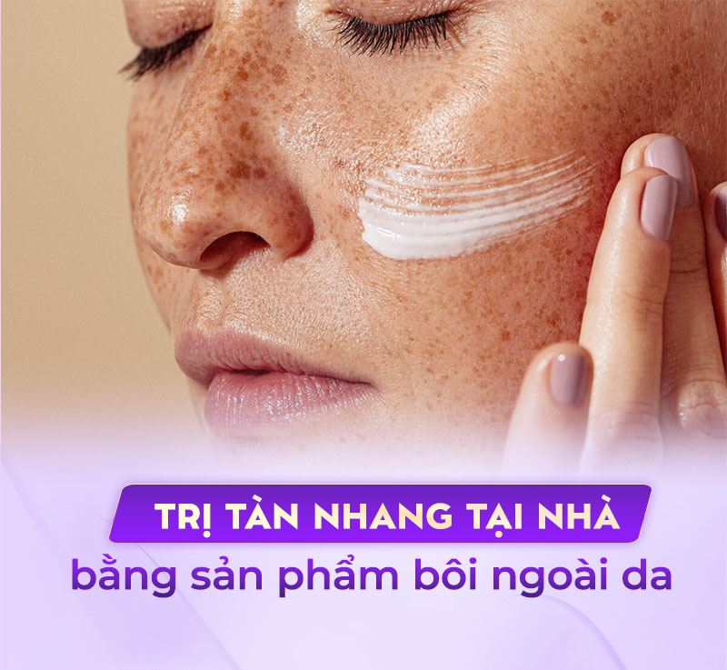 dùng kem bôi trị tàn nhang tại nhà