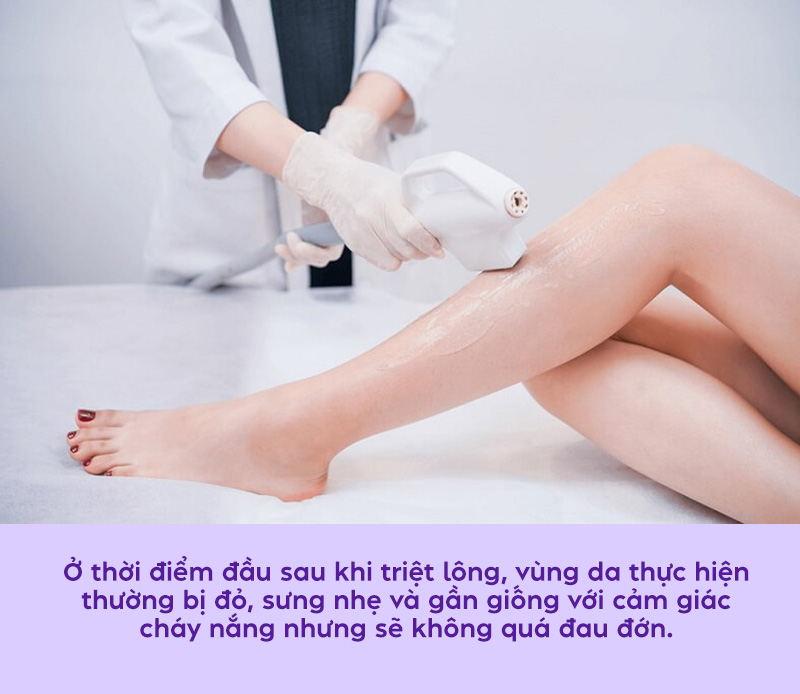 triệt long bang laser có đau không triệt long bang laser có đau không