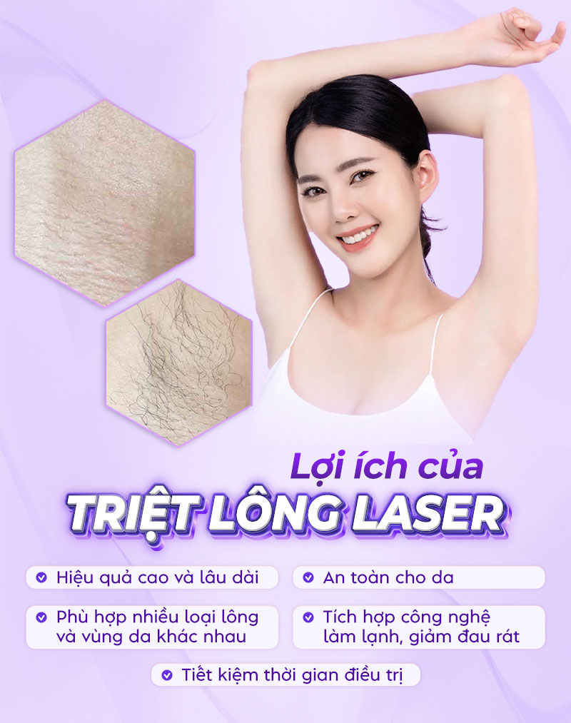 triệt lông bằng laser giá bao nhiêu triệt lông bằng laser giá bao nhiêu