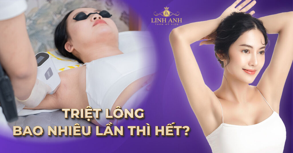 Triệt lông bao nhiêu lần thì hết