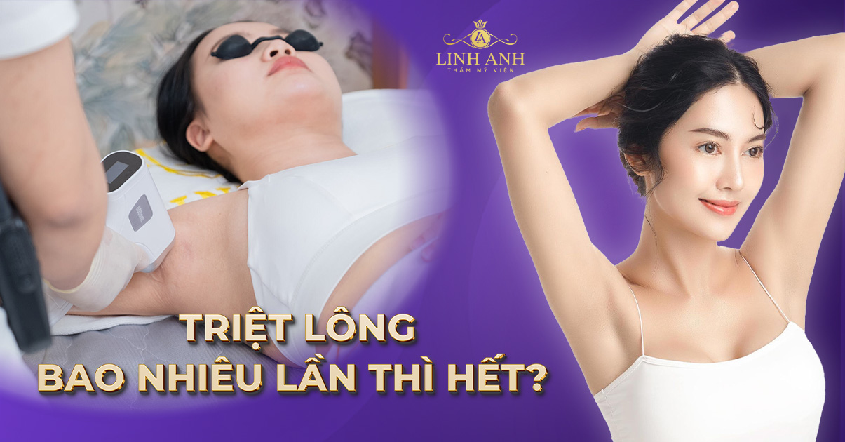 Triệt lông bao nhiêu lần thì hết? Có triệt lông vĩnh viễn được không?