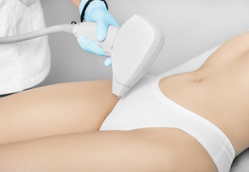 Triệt lông bikini bằng công nghệ cao