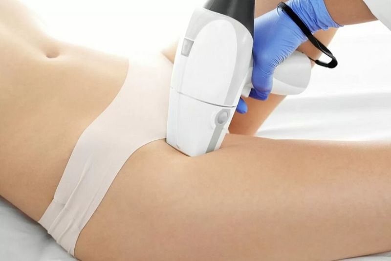 triệt lông bikini không xui triệt lông bikini không xui