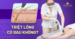 triệt lông có đau không
