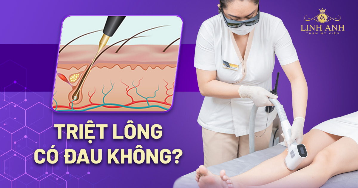 Triệt lông có đau không? Những công nghệ triệt lông không đau rát