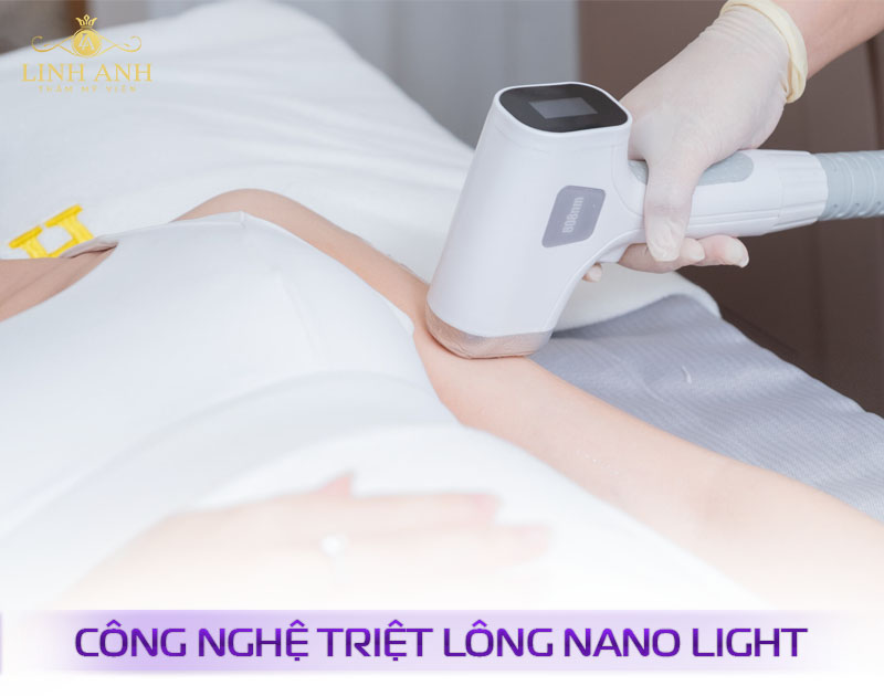triệt lông công nghệ cao triệt lông công nghệ cao