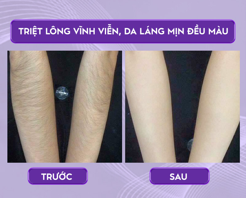 triet long khong dau triet long khong dau