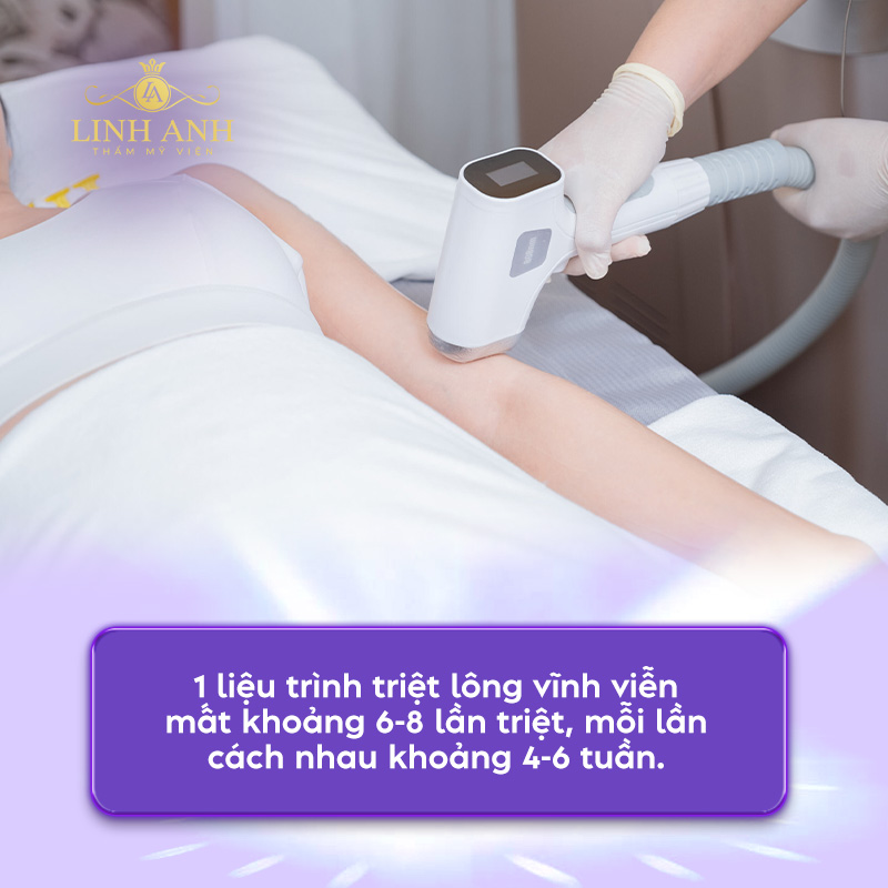 Triệt lông nách bao nhiêu lần thì hết