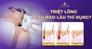 Triệt lông sau bao lâu thì rụng