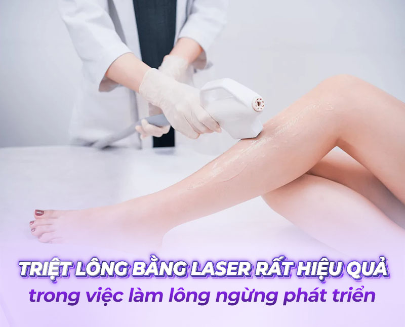 triệt lông vĩnh viễn bằng laser triệt lông vĩnh viễn bằng laser