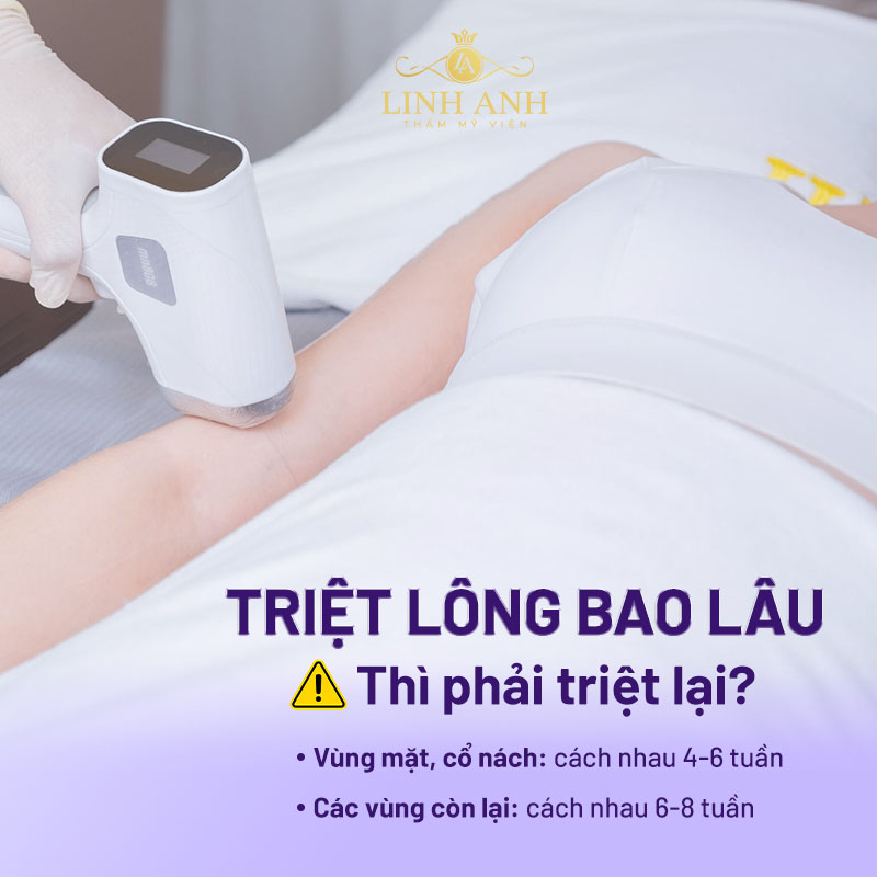 triệt lông vĩnh viễn bao lâu thì mọc lại triệt lông vĩnh viễn bao lâu thì mọc lại