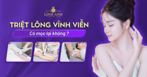 triệt lông vĩnh viễn có mọc lại không