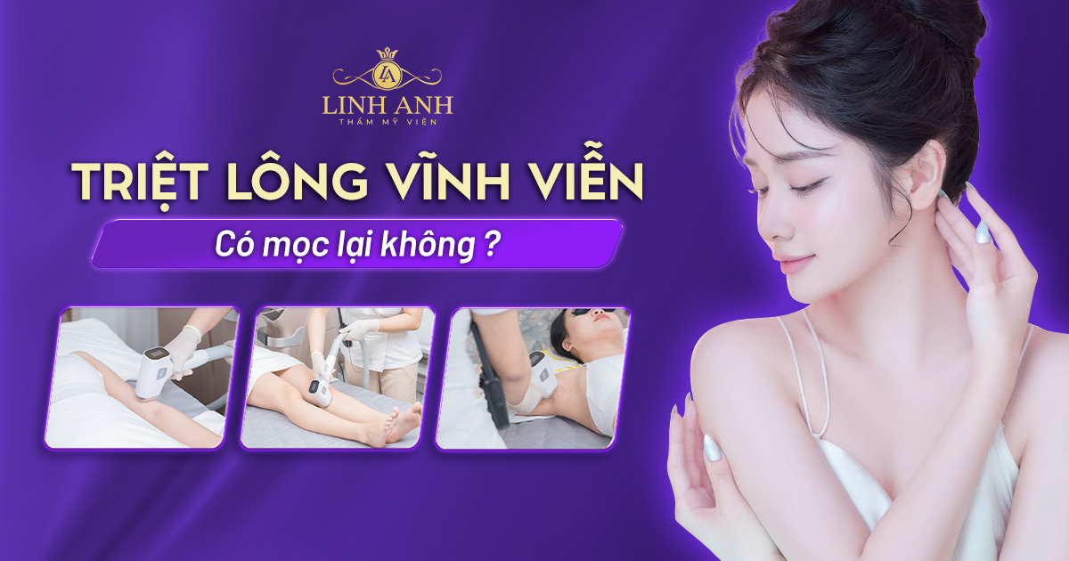 Triệt lông vĩnh viễn có mọc lại không? Những lưu ý cần nắm