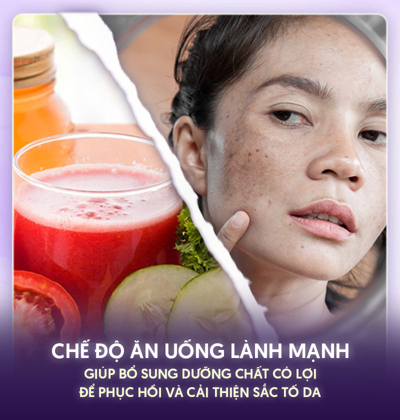 Tầm quan trọng của chế độ ăn uống trong trị nám