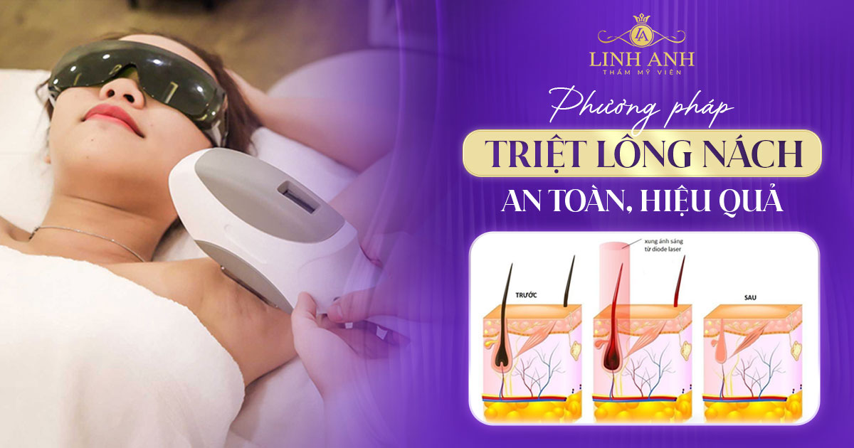 triệt lông nách