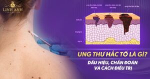 Ung thư hắc tố