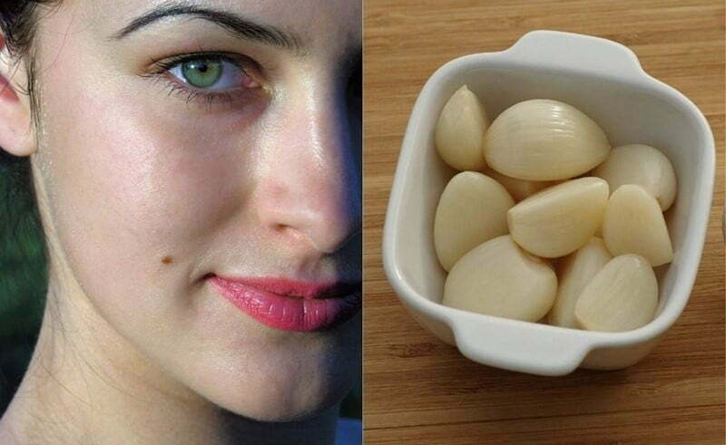 Cách tẩy nốt ruồi bằng tỏi