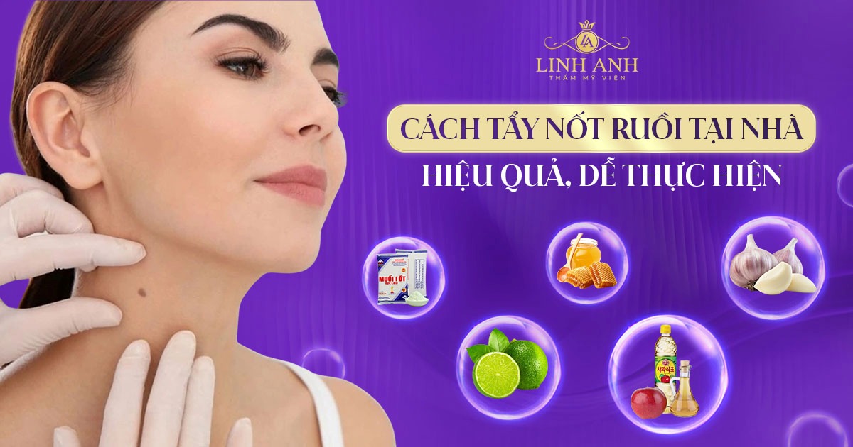 Cách tẩy nốt ruồi tại nhà