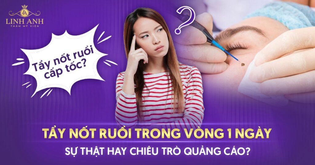 Cách tẩy nốt ruồi trong 1 ngày