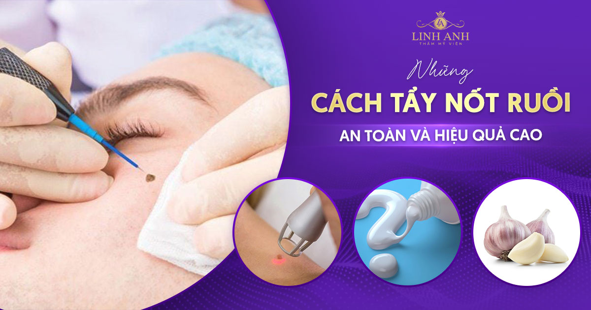 Cách tẩy nốt ruồi