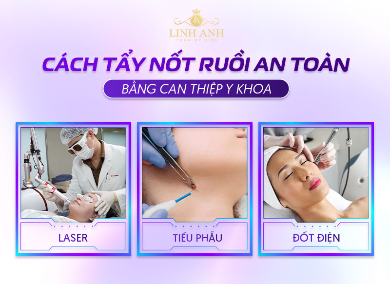 Cách tẩy xóa nốt ruồi an toàn nhất hiện nay