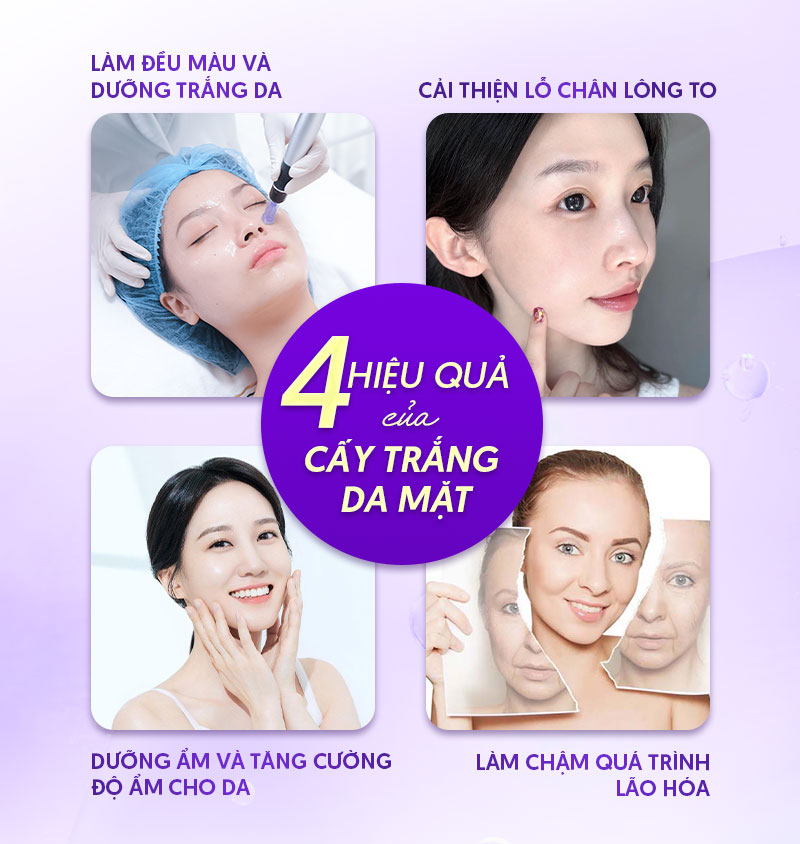Cấy trắng da mặt có tốt không Cấy trắng da mặt có tốt không