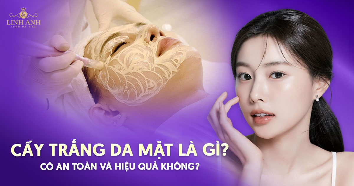 Cấy trắng da mặt là gì? Có an toàn và hiệu quả không?