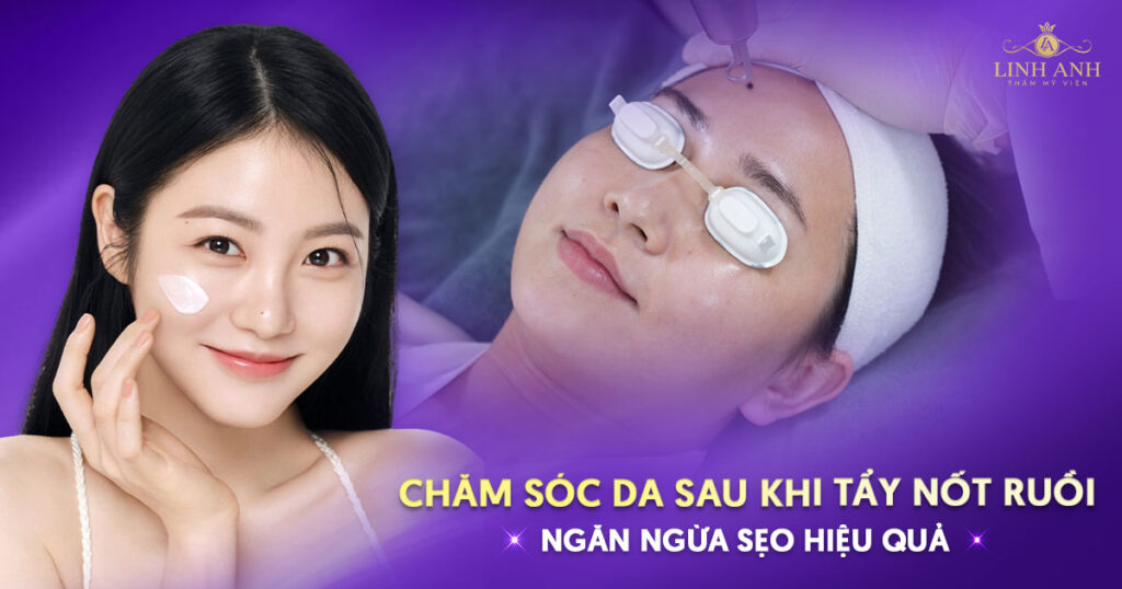 Chăm sóc da sau khi tẩy nốt ruồi