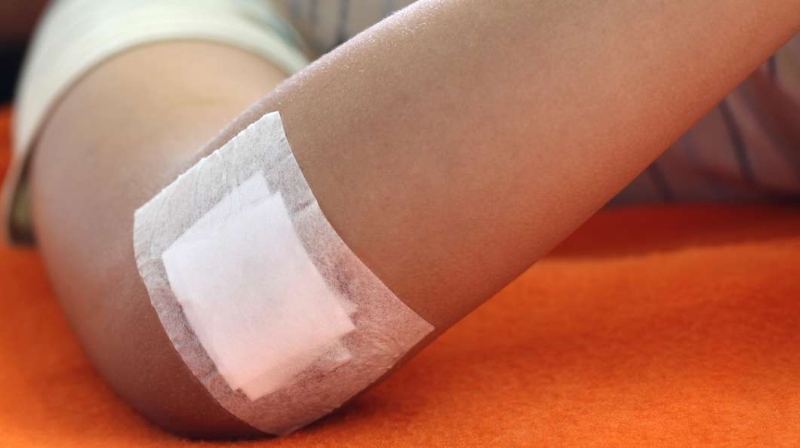 Chăm sóc da sau khi tẩy nốt ruồi bằng laser