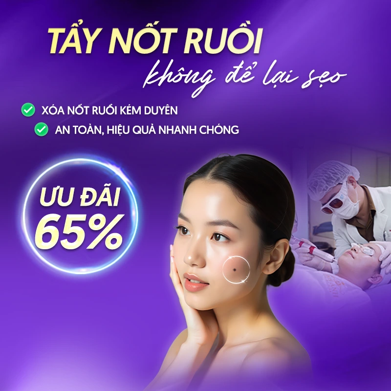 cta tay not ruoi mobile
