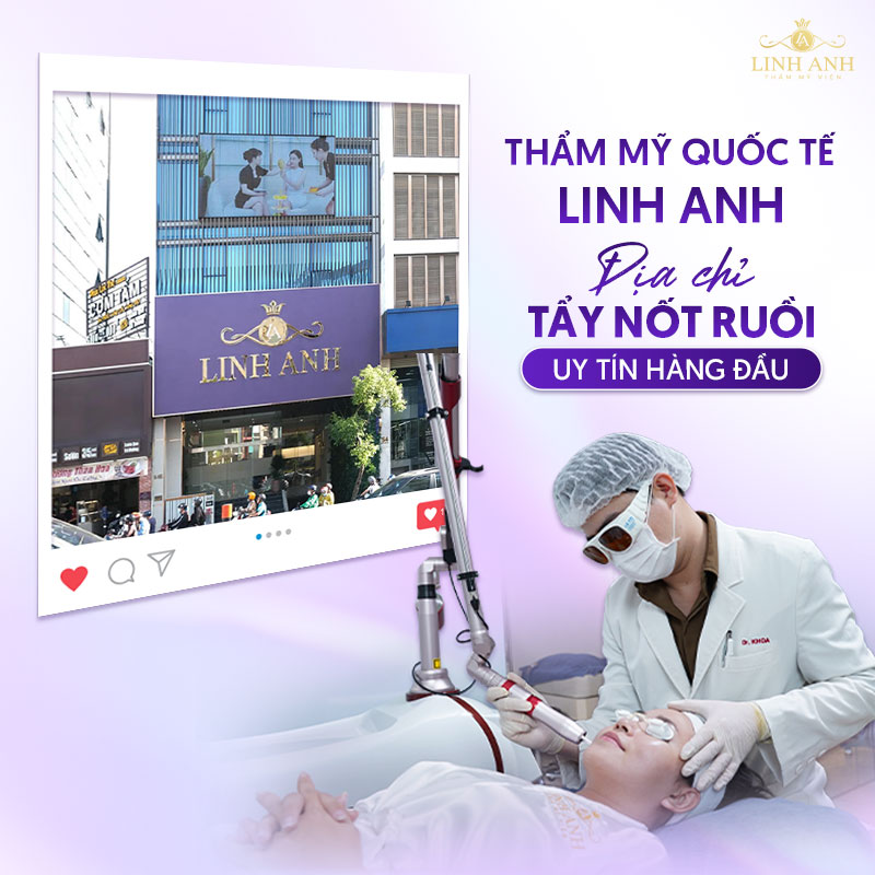 Địa chỉ tẩy nốt ruồi uy tín tại Bình Dương