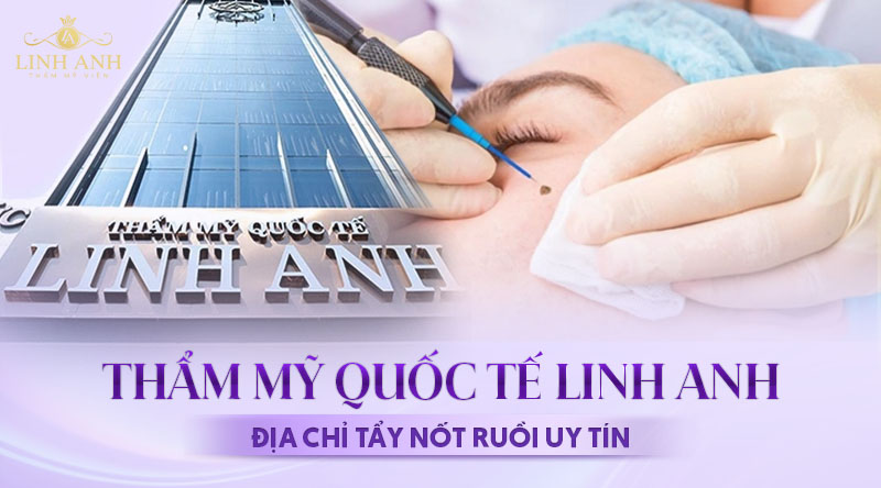 Địa chỉ tẩy nốt ruồi uy tín TP.HCM